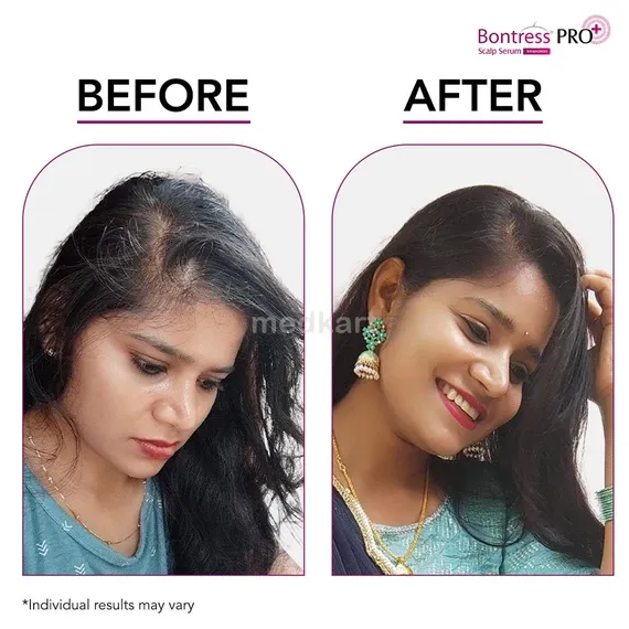 bontress pro plus scalp serum 60 ml